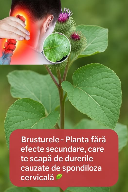 Spondiloza cervicală, boala gâtului modern: ce este, cum se manifestă și ce tratamente naturiste pot ajuta