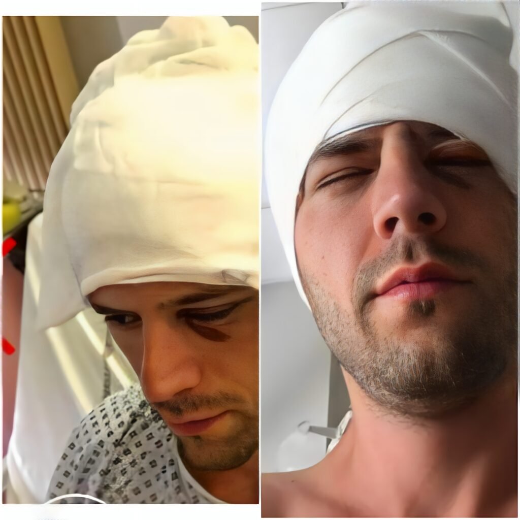 Adi Nartea, Diagnosticat Cu Două Tumori La Cap. Cum A Aflat Actorul Că Viața Îi Este În Pericol: „Să Cad Pe Stradă, Nu-Mi Venea Să Cred”