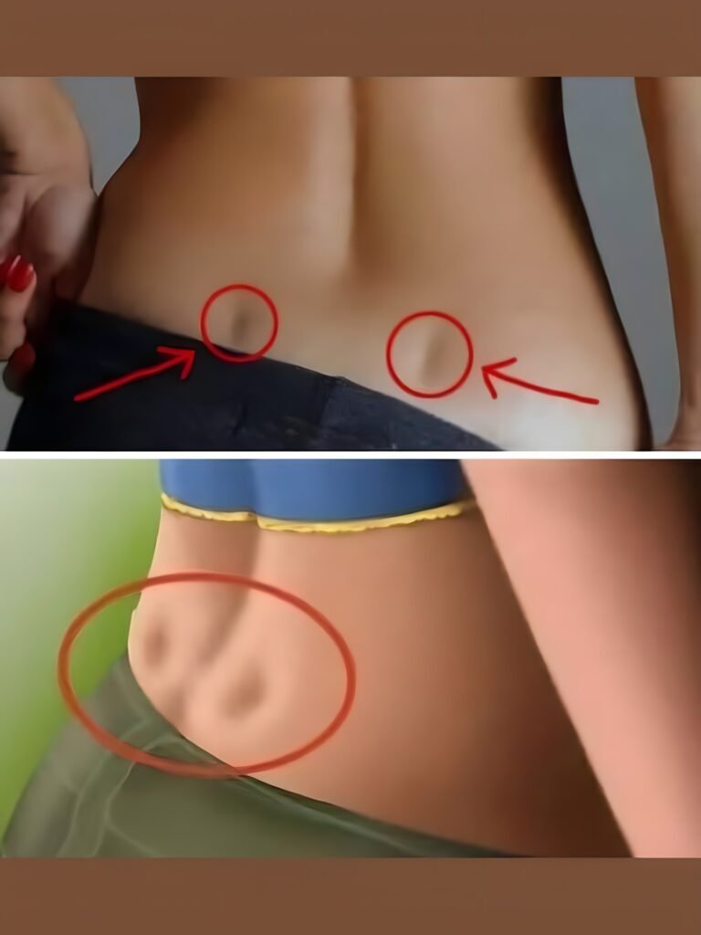 Ce înseamnă dacă ai două gropițe pe partea inferioară a spatelui