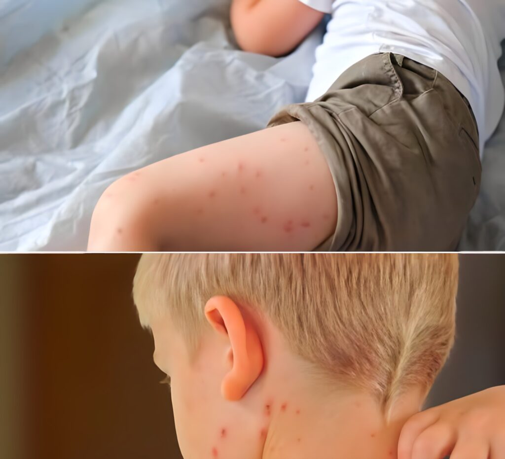 Un nou simptom COVID care se vede pe pielea copiilor. Medicii semnalează o nouă formă a virusului