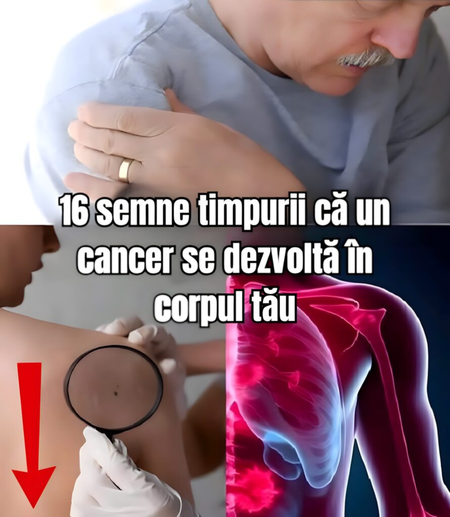16 semne timpurii că un cancer se dezvoltă în corpul tău