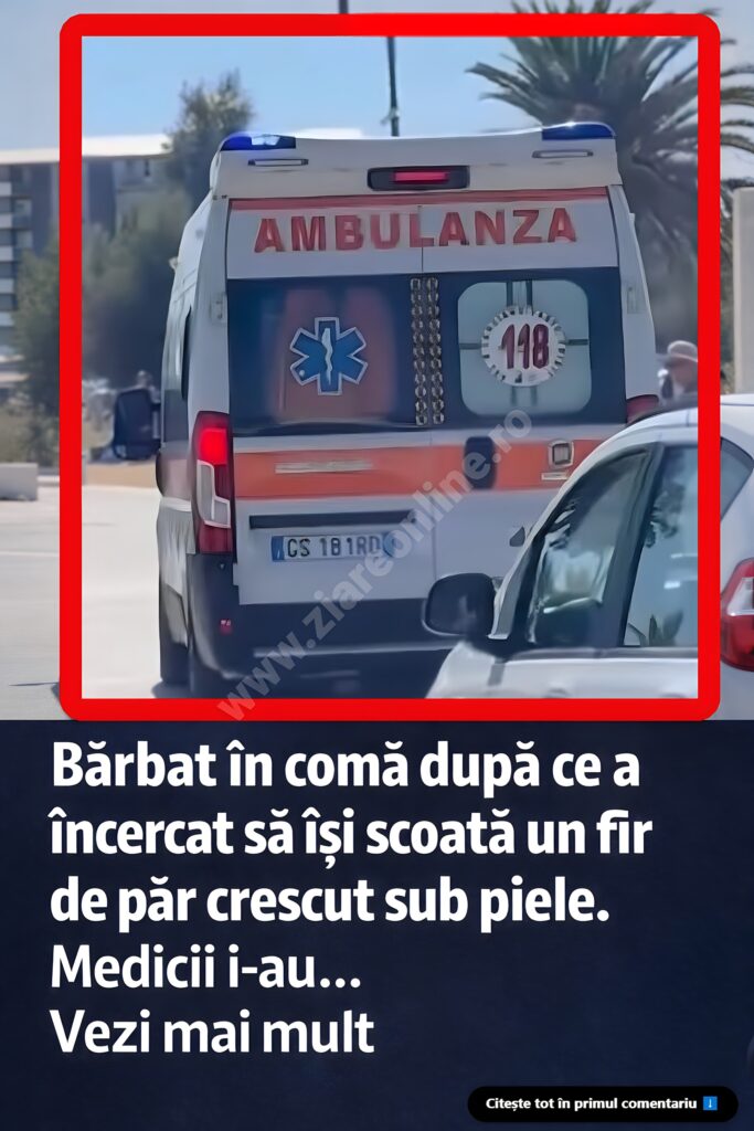 Bărbat ajuns în comă după ce a încercat să își scoată un fir de păr crescut sub piele. Medicii i-au dat 4% șanse să trăiască, însă familia î